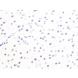 Immunohistochemistry - Anti-Mad2L2/REV7 Antibody [ARC1126] (A305858) - Antibodies.com