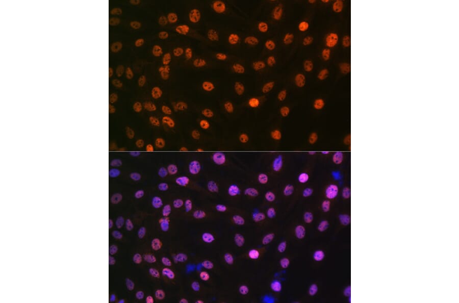 Immunofluorescence - Anti-Mad2L2/REV7 Antibody [ARC1126] (A305858) - Antibodies.com