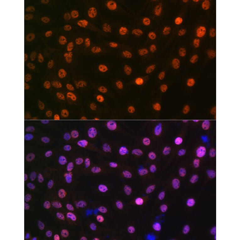 Immunofluorescence - Anti-Mad2L2/REV7 Antibody [ARC1126] (A305858) - Antibodies.com
