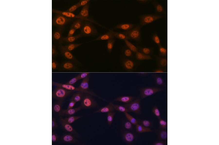 Immunofluorescence - Anti-Mad2L2/REV7 Antibody [ARC1126] (A305858) - Antibodies.com