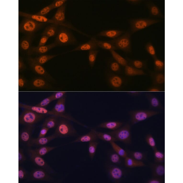 Immunofluorescence - Anti-Mad2L2/REV7 Antibody [ARC1126] (A305858) - Antibodies.com