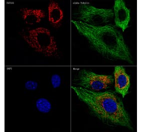 Immunofluorescence - Anti-UGT1A1 Antibody [ARC57750] (A305860) - Antibodies.com