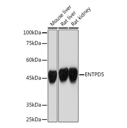 Western Blot - Anti-ENTPD5 Antibody [ARC2210] (A305861) - Antibodies.com