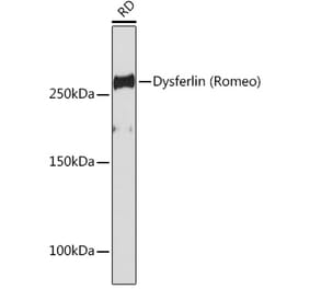 Western Blot - Anti-Dysferlin Antibody [ARC2178] (A305862) - Antibodies.com