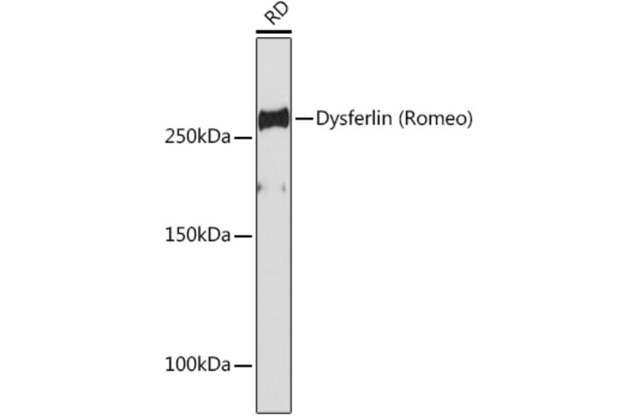 Western Blot - Anti-Dysferlin Antibody [ARC2178] (A305862) - Antibodies.com