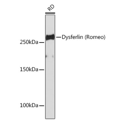 Western Blot - Anti-Dysferlin Antibody [ARC2178] (A305862) - Antibodies.com