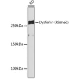 Western Blot - Anti-Dysferlin Antibody [ARC2178] (A305862) - Antibodies.com