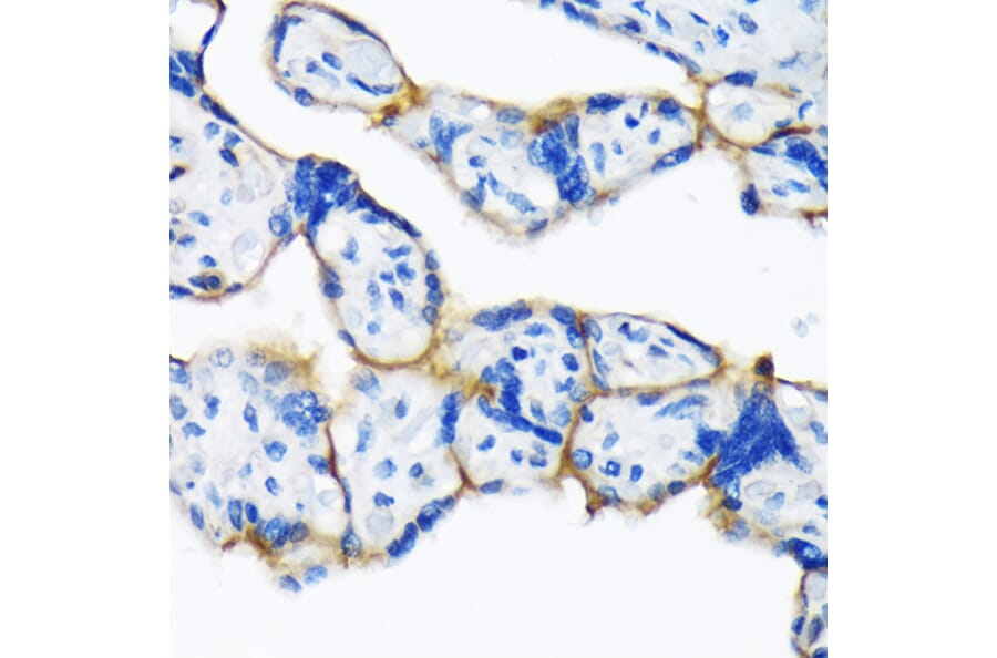 Immunohistochemistry - Anti-Dysferlin Antibody [ARC2178] (A305862) - Antibodies.com