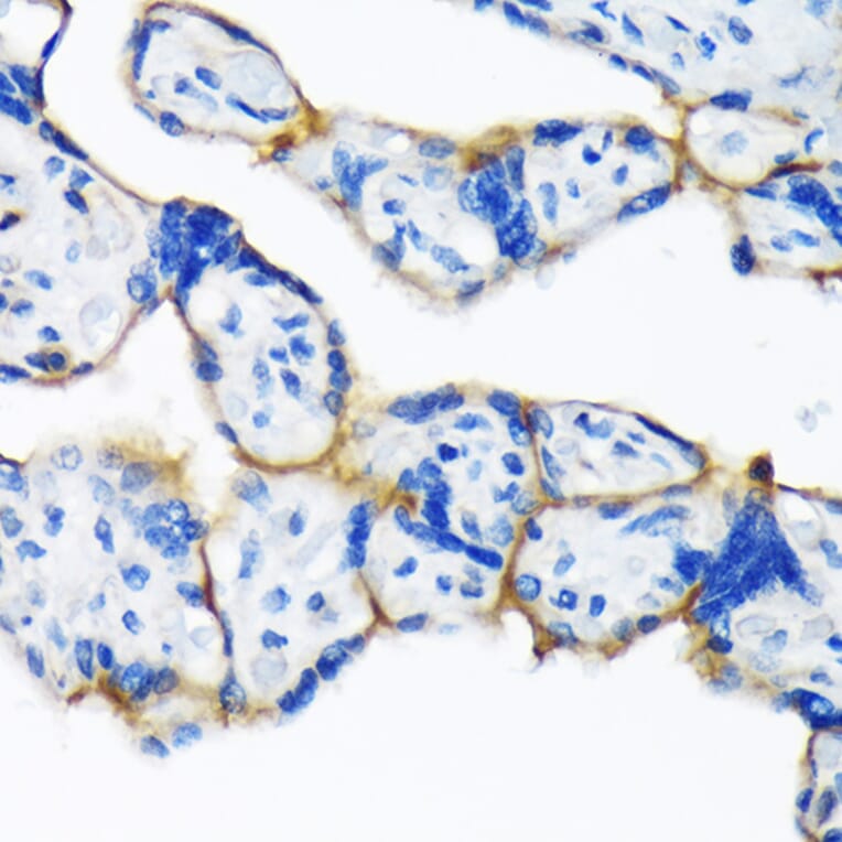 Immunohistochemistry - Anti-Dysferlin Antibody [ARC2178] (A305862) - Antibodies.com