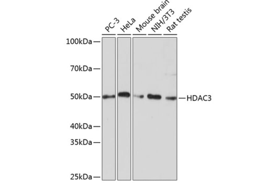Western Blot - Anti-HDAC3 Antibody [ARC0016] (A305863) - Antibodies.com