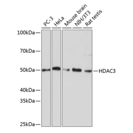 Western Blot - Anti-HDAC3 Antibody [ARC0016] (A305863) - Antibodies.com