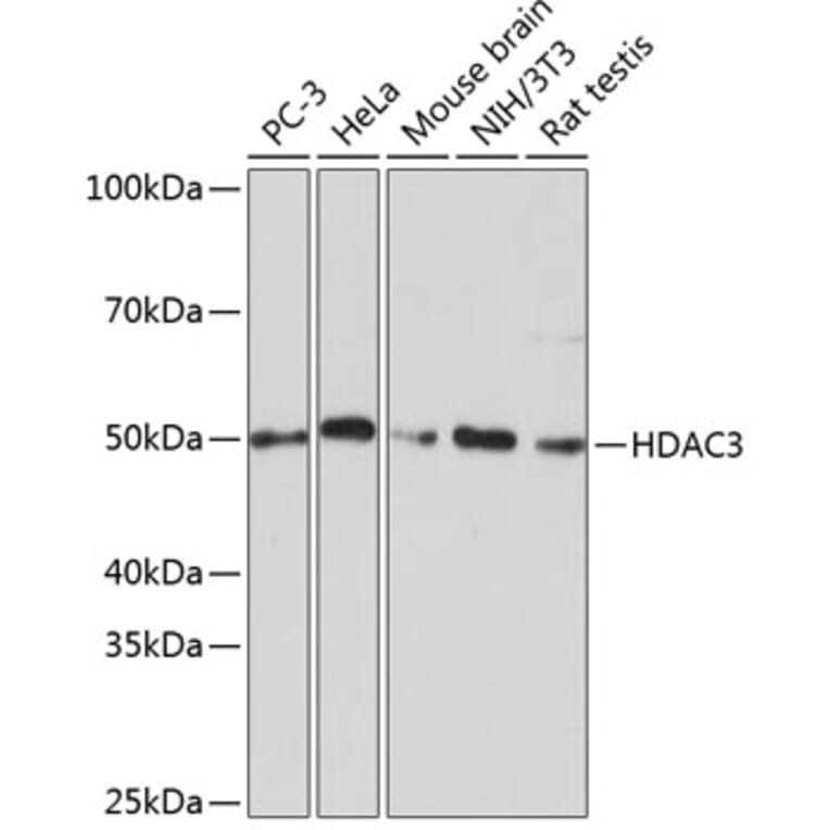 Western Blot - Anti-HDAC3 Antibody [ARC0016] (A305863) - Antibodies.com