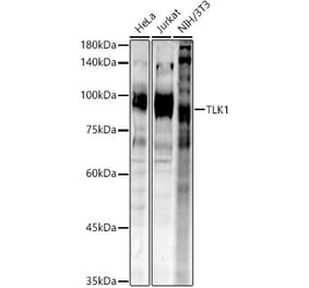 Western Blot - Anti-TLK1 (phospho hospho S743) Antibody (A305864) - Antibodies.com