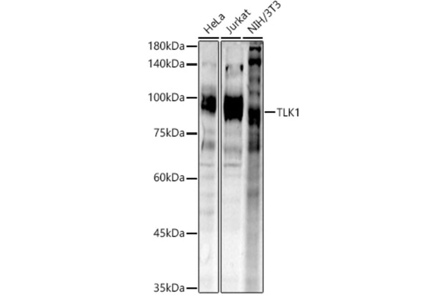 Western Blot - Anti-TLK1 (phospho hospho S743) Antibody (A305864) - Antibodies.com