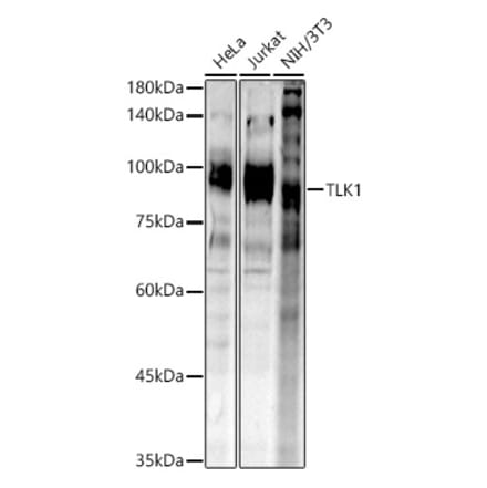 Western Blot - Anti-TLK1 (phospho hospho S743) Antibody (A305864) - Antibodies.com
