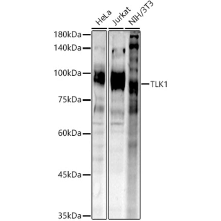 Western Blot - Anti-TLK1 (phospho hospho S743) Antibody (A305864) - Antibodies.com