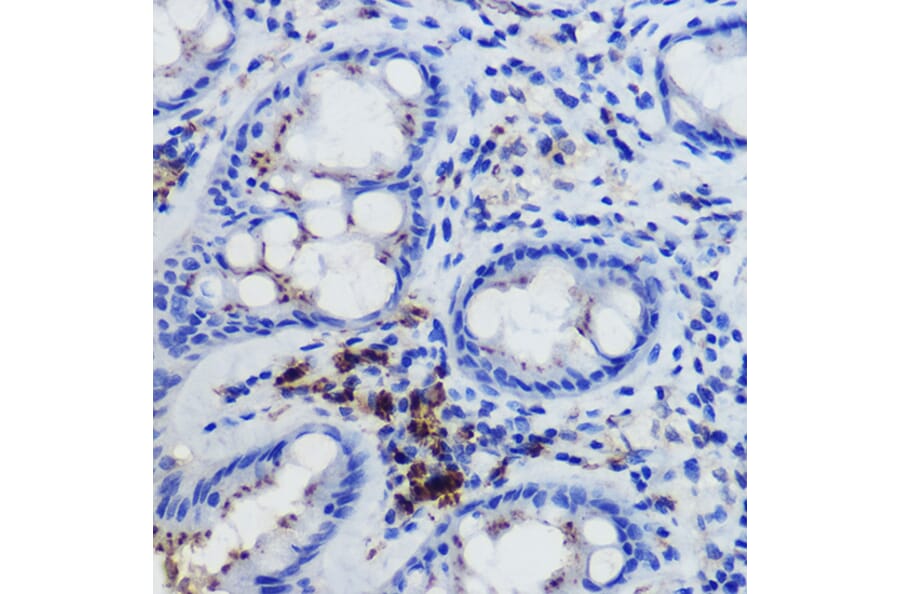 Immunohistochemistry - Anti-FPR1 Antibody (A305865) - Antibodies.com