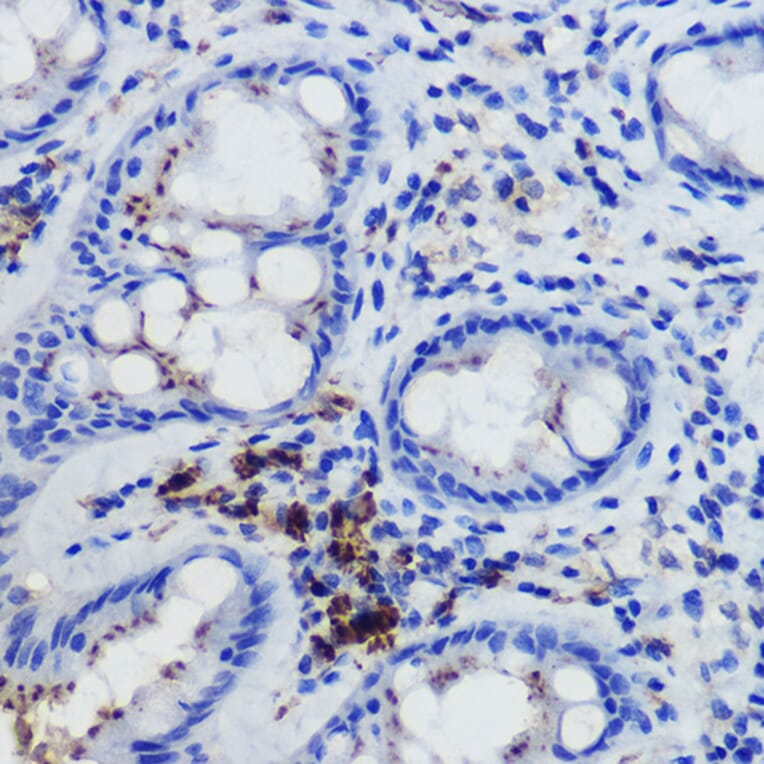 Immunohistochemistry - Anti-FPR1 Antibody (A305865) - Antibodies.com