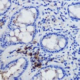 Immunohistochemistry - Anti-FPR1 Antibody (A305865) - Antibodies.com