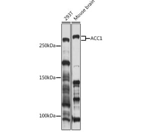 Western Blot - Anti-Acetyl Coenzyme A carboxylase alpha Antibody (A305866) - Antibodies.com