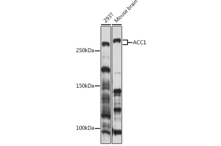 Western Blot - Anti-Acetyl Coenzyme A carboxylase alpha Antibody (A305866) - Antibodies.com