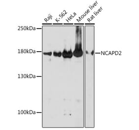 Western Blot - Anti-NCAPD2 Antibody (A305867) - Antibodies.com