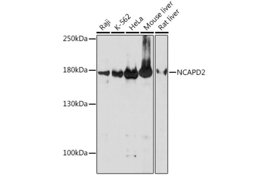 Western Blot - Anti-NCAPD2 Antibody (A305867) - Antibodies.com