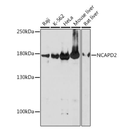 Western Blot - Anti-NCAPD2 Antibody (A305867) - Antibodies.com