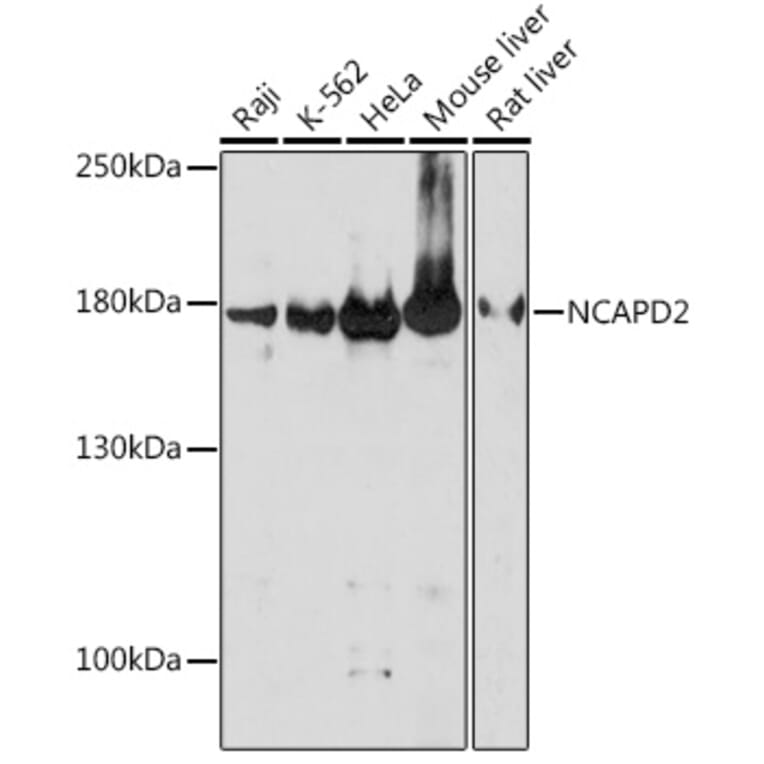 Western Blot - Anti-NCAPD2 Antibody (A305867) - Antibodies.com