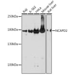 Western Blot - Anti-NCAPD2 Antibody (A305867) - Antibodies.com
