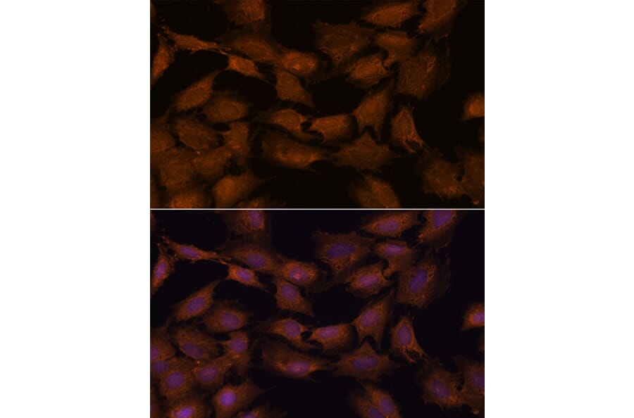Immunofluorescence - Anti-NCAPD2 Antibody (A305867) - Antibodies.com