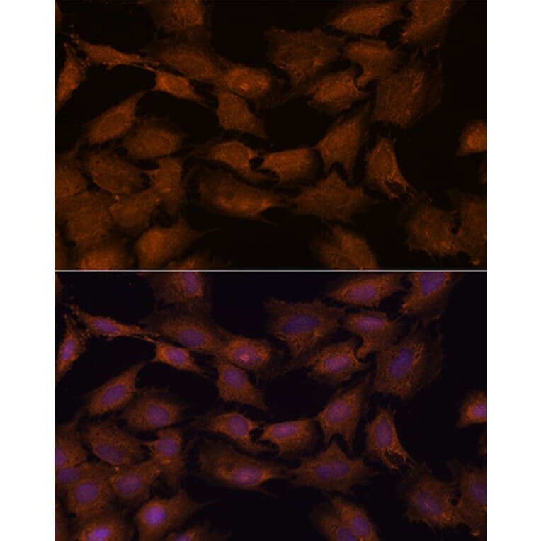 Immunofluorescence - Anti-NCAPD2 Antibody (A305867) - Antibodies.com