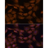 Immunofluorescence - Anti-NCAPD2 Antibody (A305867) - Antibodies.com