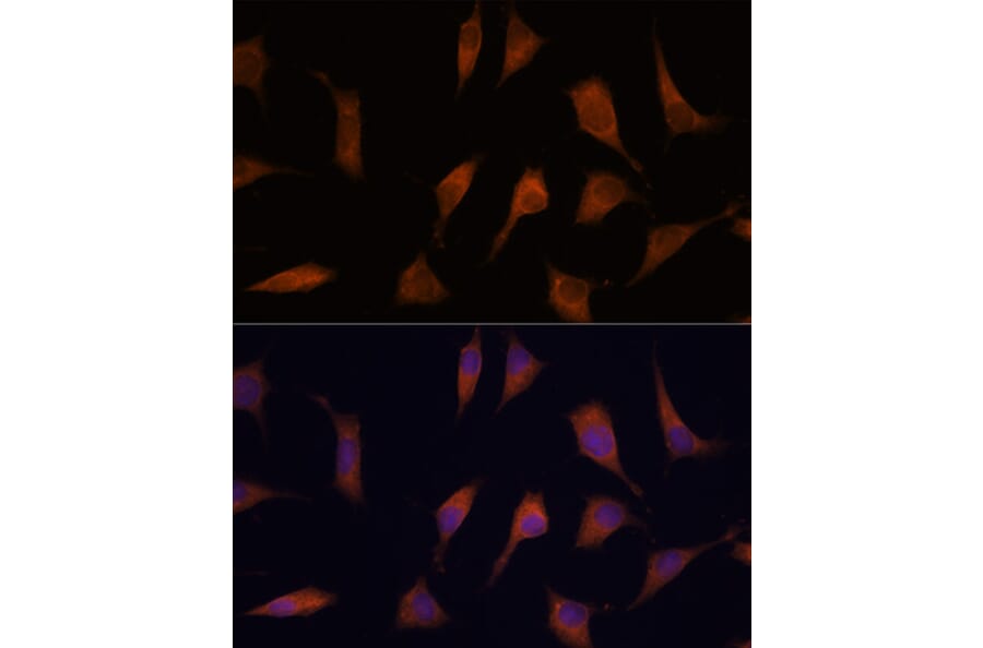 Immunofluorescence - Anti-NCAPD2 Antibody (A305867) - Antibodies.com