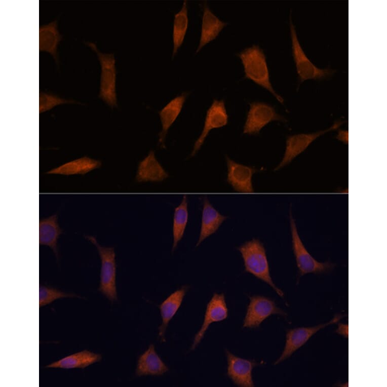 Immunofluorescence - Anti-NCAPD2 Antibody (A305867) - Antibodies.com
