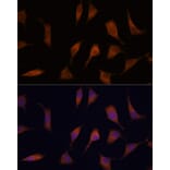 Immunofluorescence - Anti-NCAPD2 Antibody (A305867) - Antibodies.com