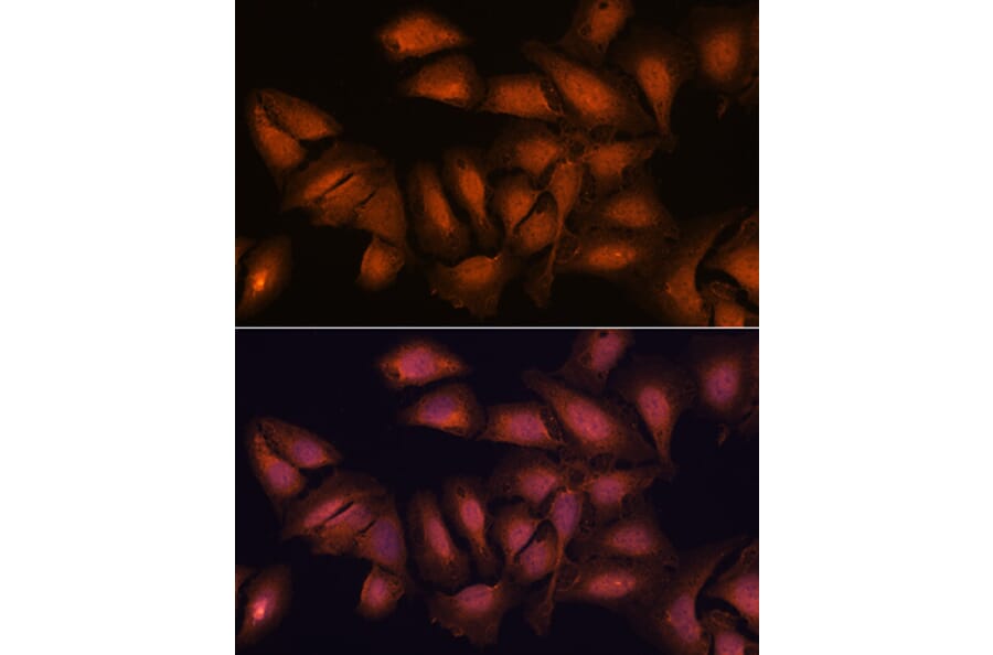 Immunofluorescence - Anti-NCAPD2 Antibody (A305867) - Antibodies.com