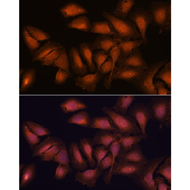 Immunofluorescence - Anti-NCAPD2 Antibody (A305867) - Antibodies.com