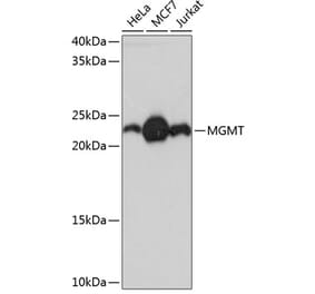 Western Blot - Anti-MGMT Antibody [ARC0529] (A305868) - Antibodies.com