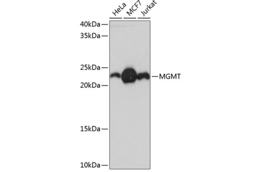 Western Blot - Anti-MGMT Antibody [ARC0529] (A305868) - Antibodies.com