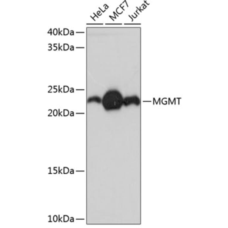 Western Blot - Anti-MGMT Antibody [ARC0529] (A305868) - Antibodies.com