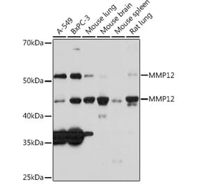 Western Blot - Anti-MMP12 Antibody [ARC0280] (A305869) - Antibodies.com