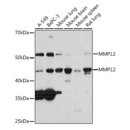 Western Blot - Anti-MMP12 Antibody [ARC0280] (A305869) - Antibodies.com
