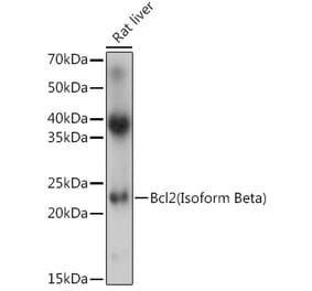 Western Blot - Anti-Bcl-2 Antibody (A305870) - Antibodies.com