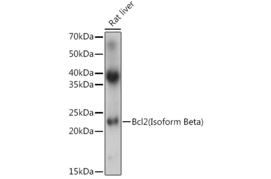 Western Blot - Anti-Bcl-2 Antibody (A305870) - Antibodies.com