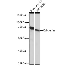 Western Blot - Anti-Calmegin Antibody [ARC2214] (A305871) - Antibodies.com