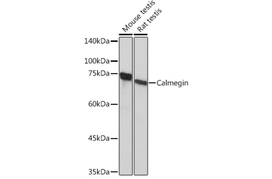 Western Blot - Anti-Calmegin Antibody [ARC2214] (A305871) - Antibodies.com