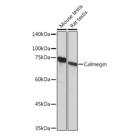 Western Blot - Anti-Calmegin Antibody [ARC2214] (A305871) - Antibodies.com