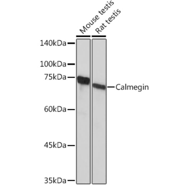 Western Blot - Anti-Calmegin Antibody [ARC2214] (A305871) - Antibodies.com