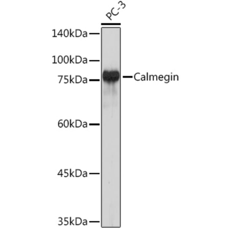 Western Blot - Anti-Calmegin Antibody [ARC2214] (A305871) - Antibodies.com